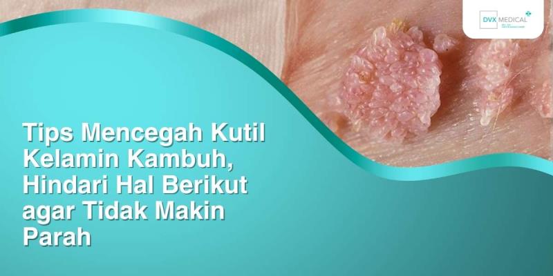 Tips Mencegah Kutil Kelamin Kambuh, Hindari Hal Berikut agar Tidak Makin Parah