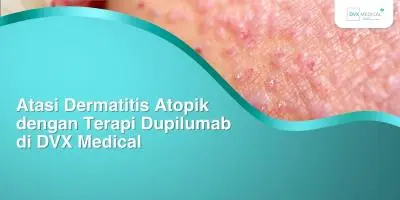 Atasi Dermatitis Atopik dengan Terapi Dupilumab di DVX Medical