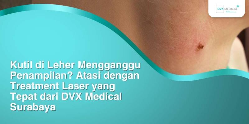 Kutil di Leher Mengganggu Penampilan? Atasi dengan Treatment Laser yang Tepat dari DVX Medical Surabaya