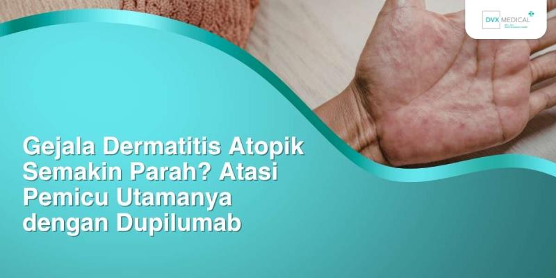 Gejala Dermatitis Atopik Semakin Parah? Atasi Pemicu Utamanya dengan Dupilumab