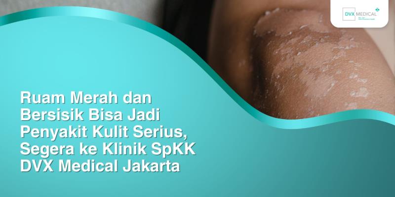 Ruam Merah dan Bersisik Bisa Jadi Penyakit Kulit Serius, Segera ke Klinik SpKK DVX Medical Jakarta