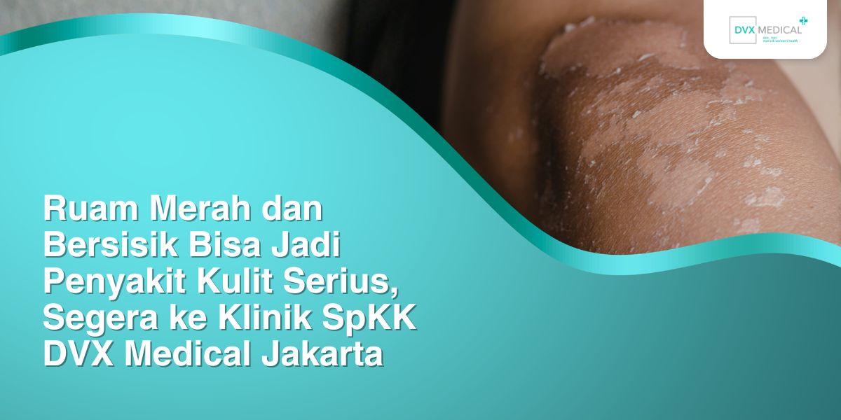 Ruam Merah Dan Bersisik Bisa Jadi Penyakit Kulit Serius, Segera Ke ...
