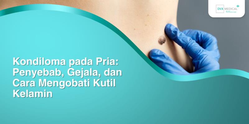 Kondiloma pada Pria: Penyebab, Gejala, dan Cara Mengobati Kutil Kelamin