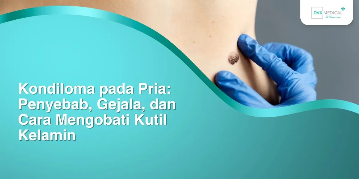 Kondiloma pada Pria: Penyebab, Gejala, dan Cara Mengobati Kutil Kelamin