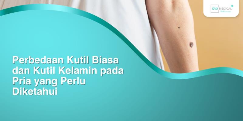 Perbedaan Kutil Biasa dan Kutil Kelamin pada Pria yang Perlu Diketahui