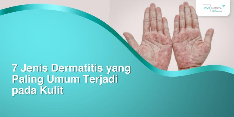 7 Jenis Dermatitis yang Paling Umum Terjadi pada Kulit