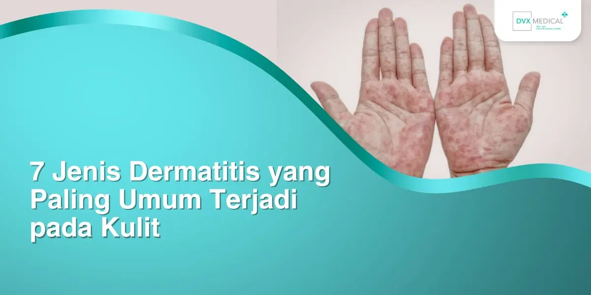 7 Jenis Dermatitis yang Paling Umum Terjadi pada Kulit