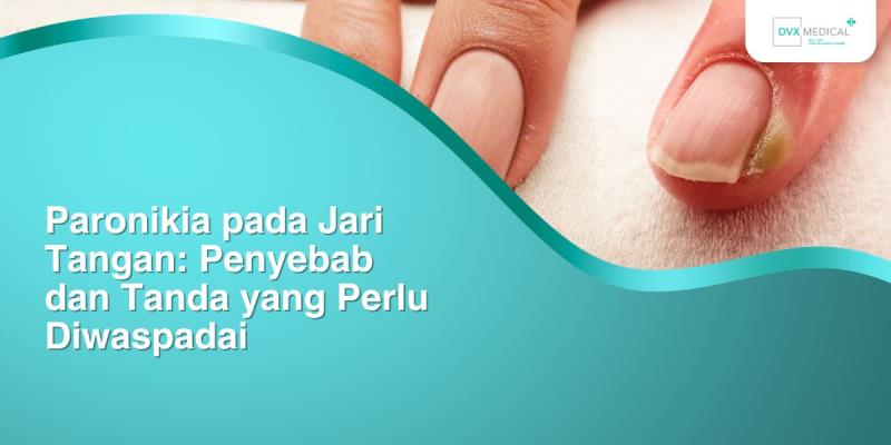 Paronikia pada Jari Tangan: Penyebab dan Tanda yang Perlu Diwaspadai