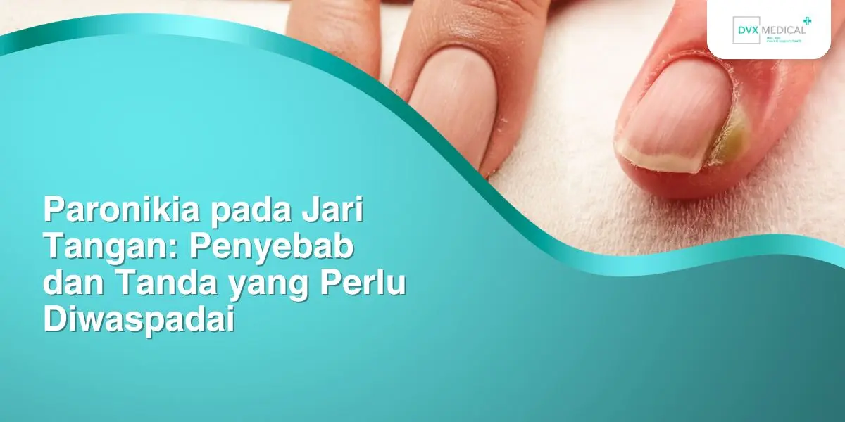 Paronikia pada Jari Tangan: Penyebab dan Tanda yang Perlu Diwaspadai