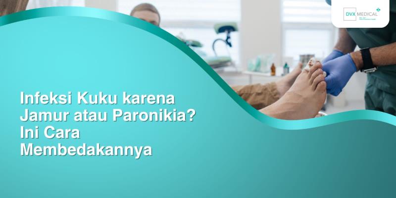Infeksi Kuku karena Jamur atau Paronikia? Ini Cara Membedakannya