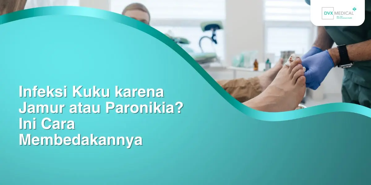 Infeksi Kuku karena Jamur atau Paronikia? Ini Cara Membedakannya