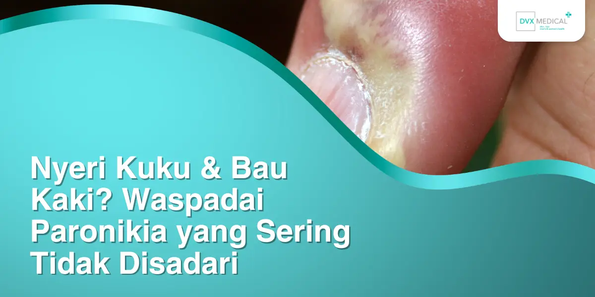 Nyeri Kuku & Bau Kaki? Waspadai Paronikia yang Sering Tidak Disadari
