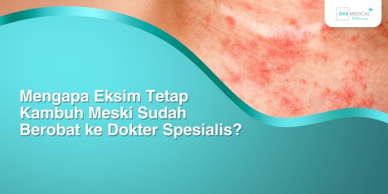 Mengapa Eksim Tetap Kambuh Meski Sudah Berobat ke Dokter Spesialis?