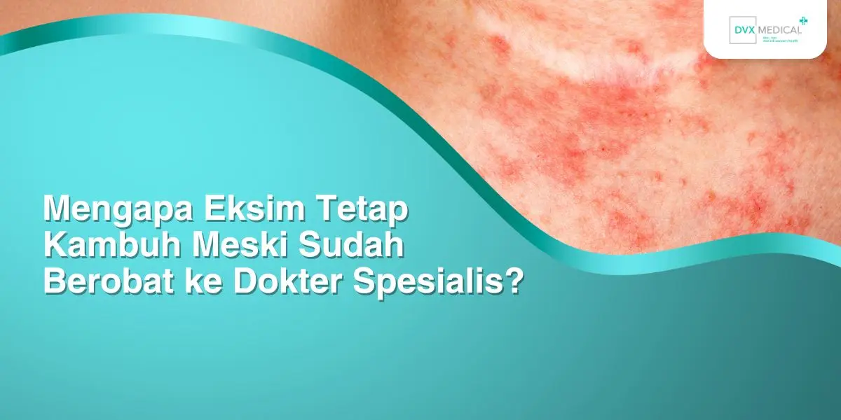 Mengapa Eksim Tetap Kambuh Meski Sudah Berobat ke Dokter Spesialis?