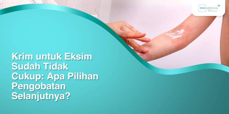 Krim untuk Eksim Sudah Tidak Cukup: Apa Pilihan Pengobatan Selanjutnya?