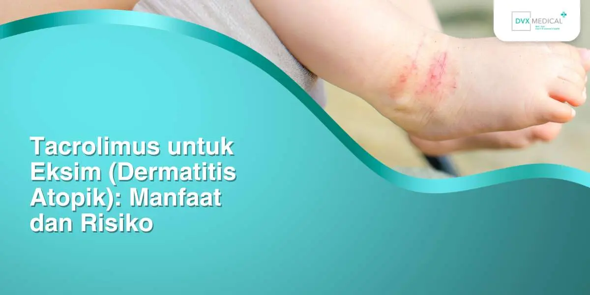 Tacrolimus untuk Eksim (Dermatitis Atopik): Manfaat dan Risiko