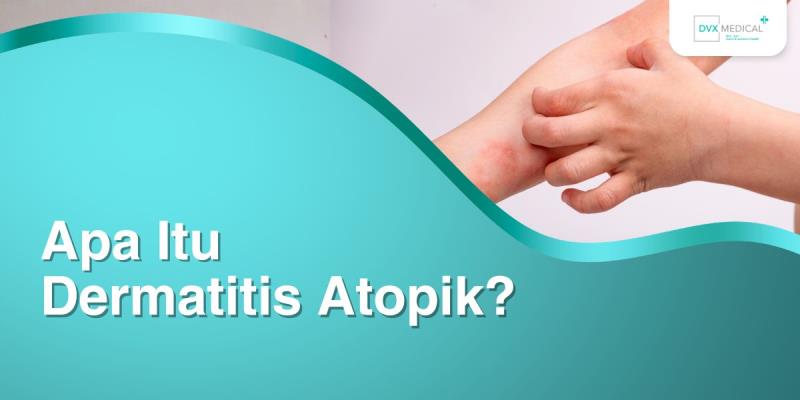 Apa Itu Dermatitis Atopik?