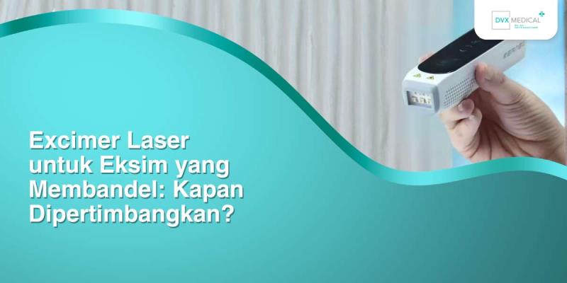 Excimer Laser untuk Eksim yang Membandel: Kapan Dipertimbangkan?