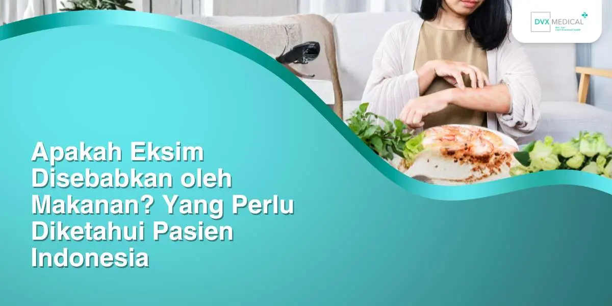 Apakah Eksim Disebabkan oleh Makanan? Yang Perlu Diketahui Pasien Indonesia
