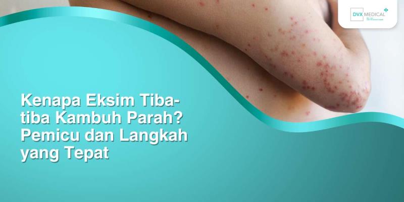 Kenapa Eksim Tiba-tiba Kambuh Parah? Pemicu dan Langkah yang Tepat