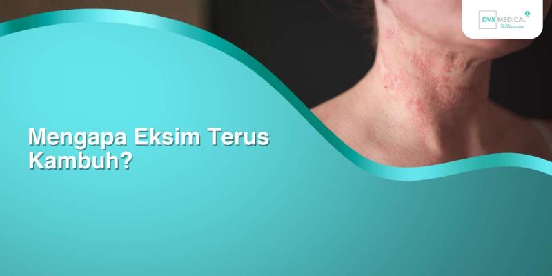 Mengapa Eksim Terus Kambuh?