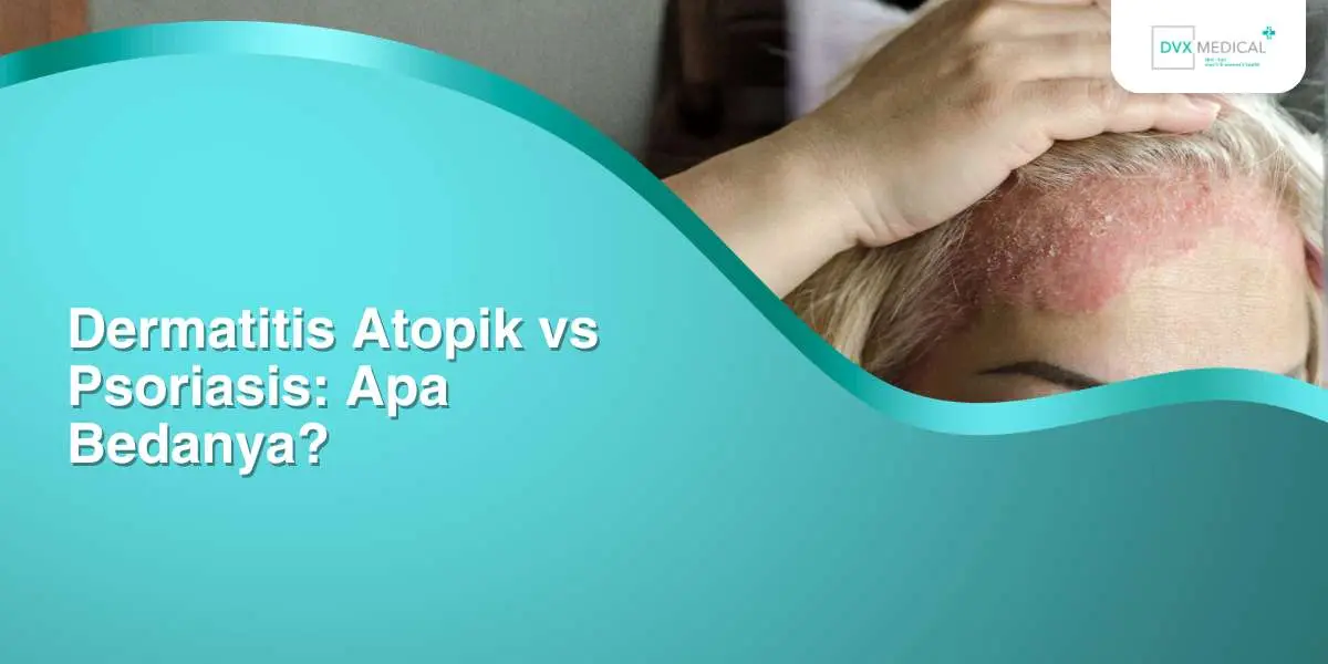 Dermatitis Atopik vs Psoriasis: Apa Bedanya?
