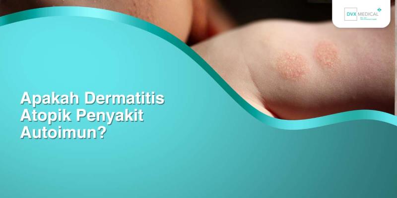 Apakah Dermatitis Atopik Penyakit Autoimun?