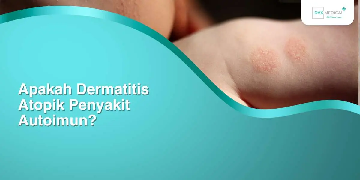 Apakah Dermatitis Atopik Penyakit Autoimun?