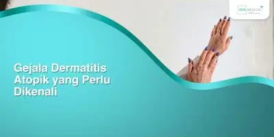 Gejala Dermatitis Atopik yang Perlu Dikenali