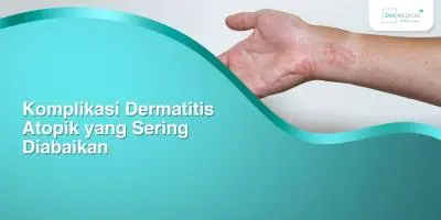 Komplikasi Dermatitis Atopik yang Sering Diabaikan