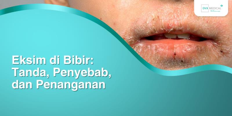 Eksim di Bibir: Tanda, Penyebab, dan Penanganan
