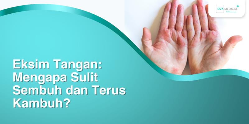 Eksim Tangan: Mengapa Sulit Sembuh dan Terus Kambuh?