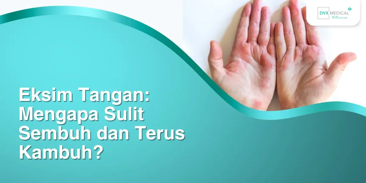 Eksim Tangan: Mengapa Sulit Sembuh dan Terus Kambuh?