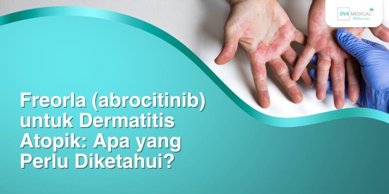 Freorla (abrocitinib) untuk Dermatitis Atopik: Apa yang Perlu Diketahui?