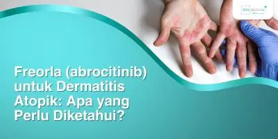 Freorla (abrocitinib) untuk Dermatitis Atopik: Apa yang Perlu Diketahui?