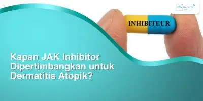 Kapan JAK Inhibitor Dipertimbangkan untuk Dermatitis Atopik?