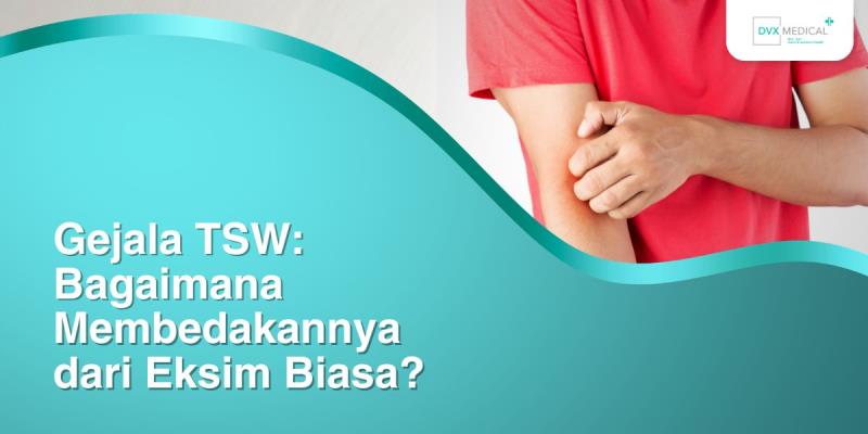 Gejala TSW: Bagaimana Membedakannya dari Eksim Biasa?