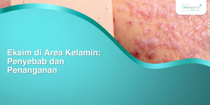 Eksim di Area Kelamin: Penyebab dan Penanganan