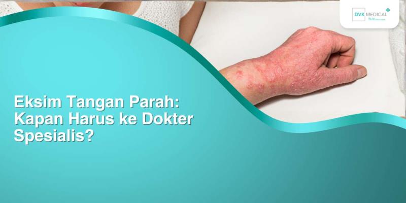 Eksim Tangan Parah: Kapan Harus ke Dokter Spesialis?