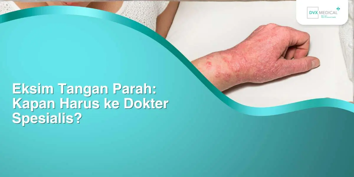 Eksim Tangan Parah: Kapan Harus ke Dokter Spesialis?