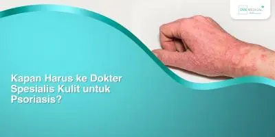 Kapan Harus ke Dokter Spesialis Kulit untuk Psoriasis?