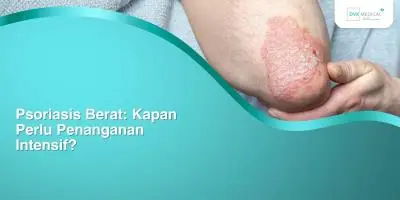 Psoriasis Berat: Kapan Perlu Penanganan Intensif?