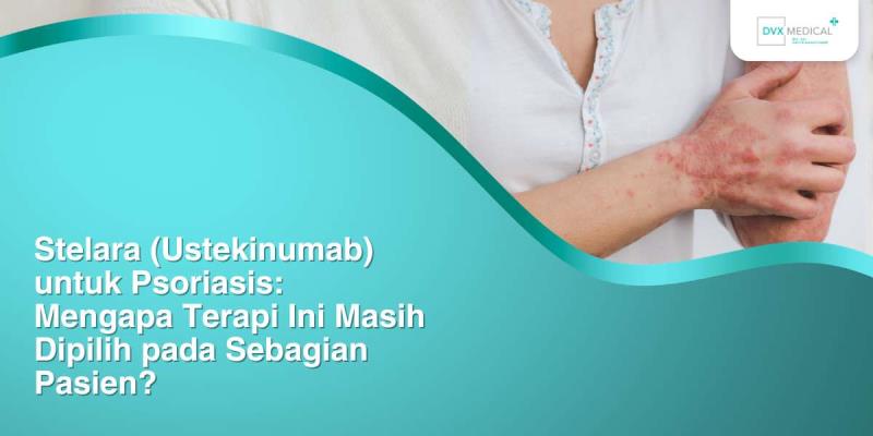 Stelara (Ustekinumab) untuk Psoriasis: Mengapa Terapi Ini Masih Dipilih pada Sebagian Pasien?