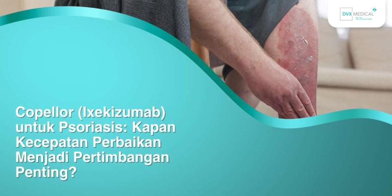 Copellor (Ixekizumab) untuk Psoriasis: Kapan Kecepatan Perbaikan Menjadi Pertimbangan Penting?
