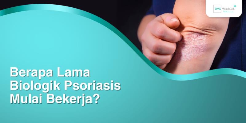 Berapa Lama Biologik Psoriasis Mulai Bekerja?
