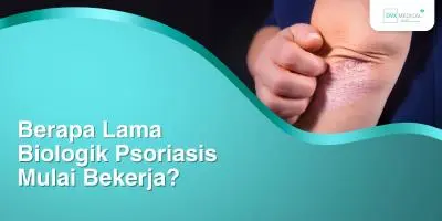 Berapa Lama Biologik Psoriasis Mulai Bekerja?