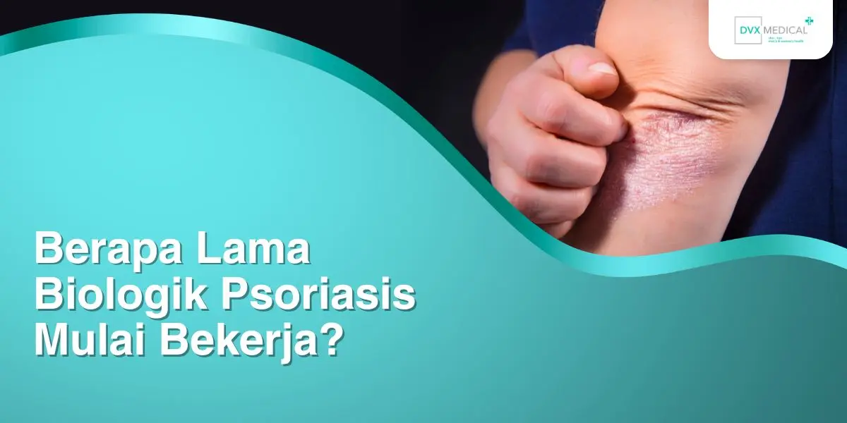 Berapa Lama Biologik Psoriasis Mulai Bekerja?