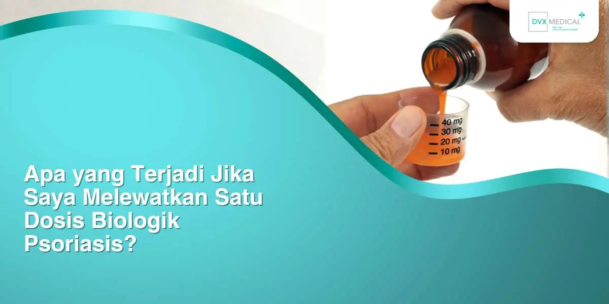 Apa yang Terjadi Jika Saya Melewatkan Satu Dosis Biologik Psoriasis?