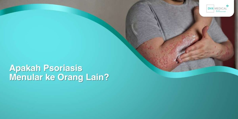 Apakah Psoriasis Menular ke Orang Lain?