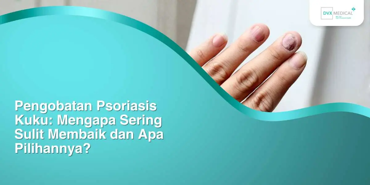 Pengobatan Psoriasis Kuku: Mengapa Sering Sulit Membaik dan Apa Pilihannya?